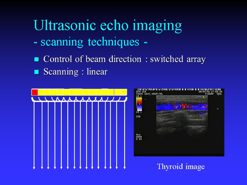 Ultrasonic echo imaging - scanning techniques - Control of beam direction : switched array